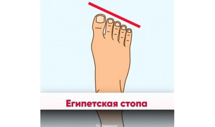 Первое место в рейтинге ступней Москвы и Санкт-Петербурга заняли Египетские стопы